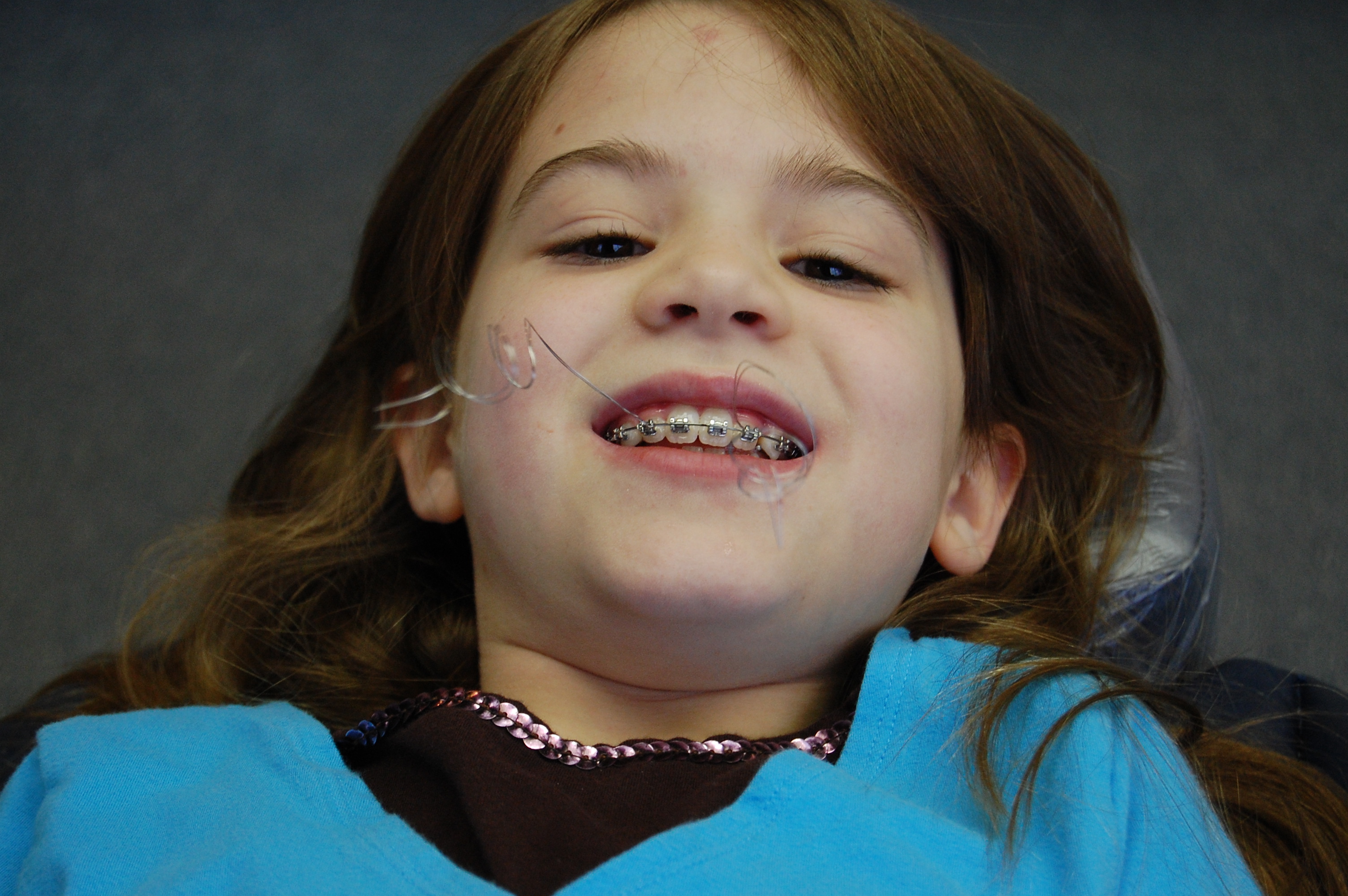 Uak Ortodonti - ocuklarda ortodontik tedavi